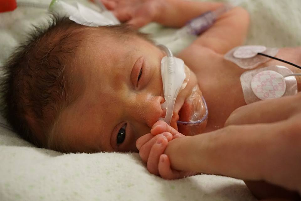 My Preemie Story Of My Little Miracle