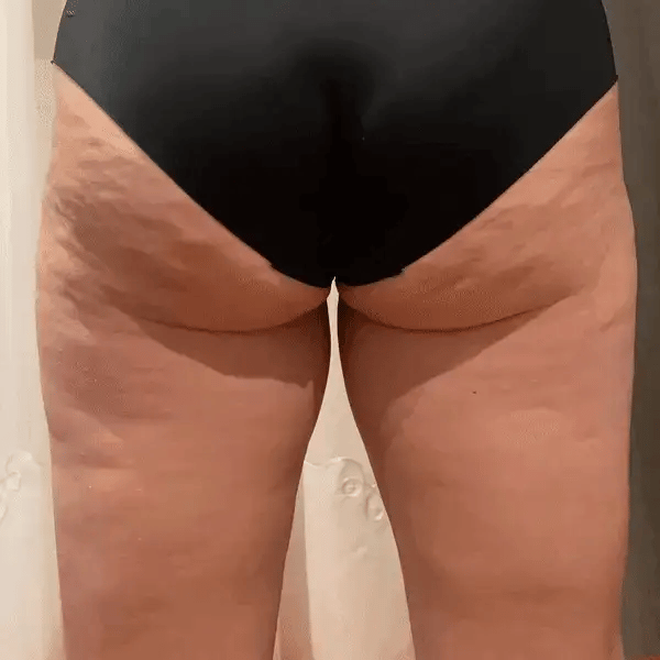Cheek Chic Cellulite Gel