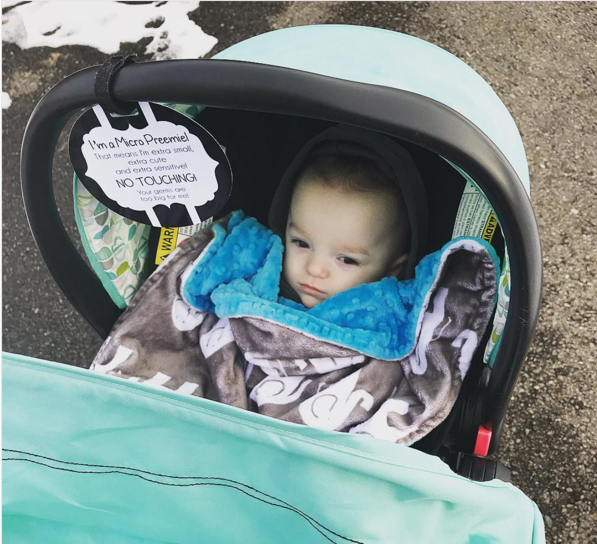 Micro Premies are babies born before 26 weeks or weighing less than 28 oz. Micro Preemies are more susceptible to germs. To keep them safe, add this Micro Preemie Sign on your car seat. 
